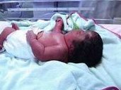 移植后前三天要注意什么？试管移植前后注意事项