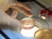 我想知道有哪些不孕不育夫妇,越早做试管婴儿越好？