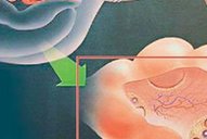 宫寒胚胎移植后的注意事项分享，不注意饮食小心前功尽弃