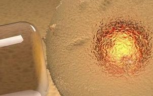 排卵期出血不影响怀孕几率!这4大危害才最为常见