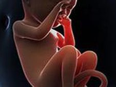 胚胎移植第35天出血怎么办？3分钟让你远离流产风险